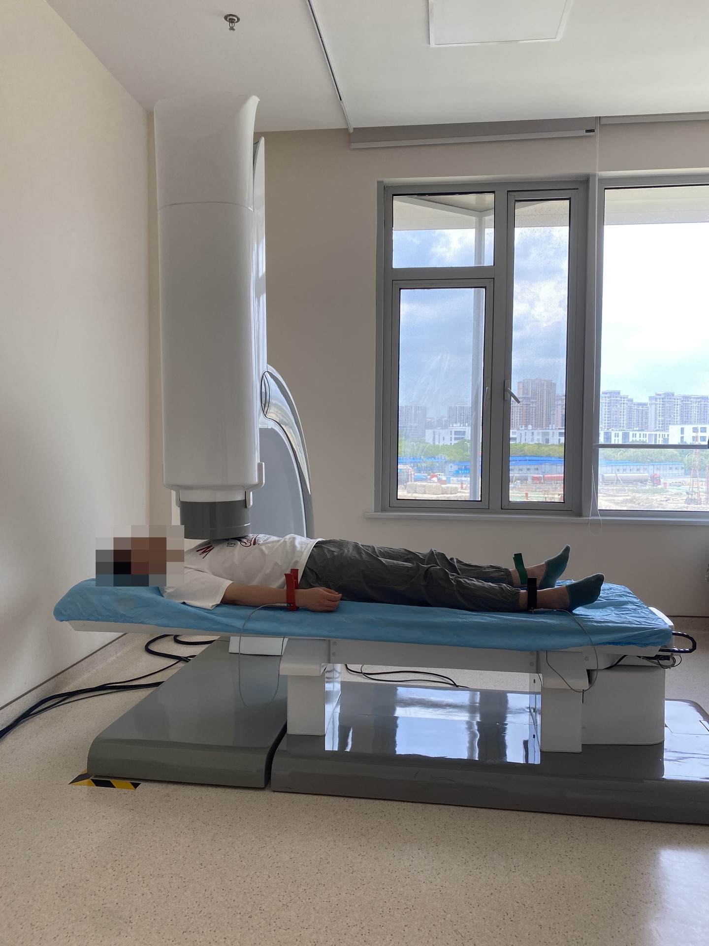 SQUID 设备实景：胸部上方探测装置与检查床，受检者面部已作马赛克处理