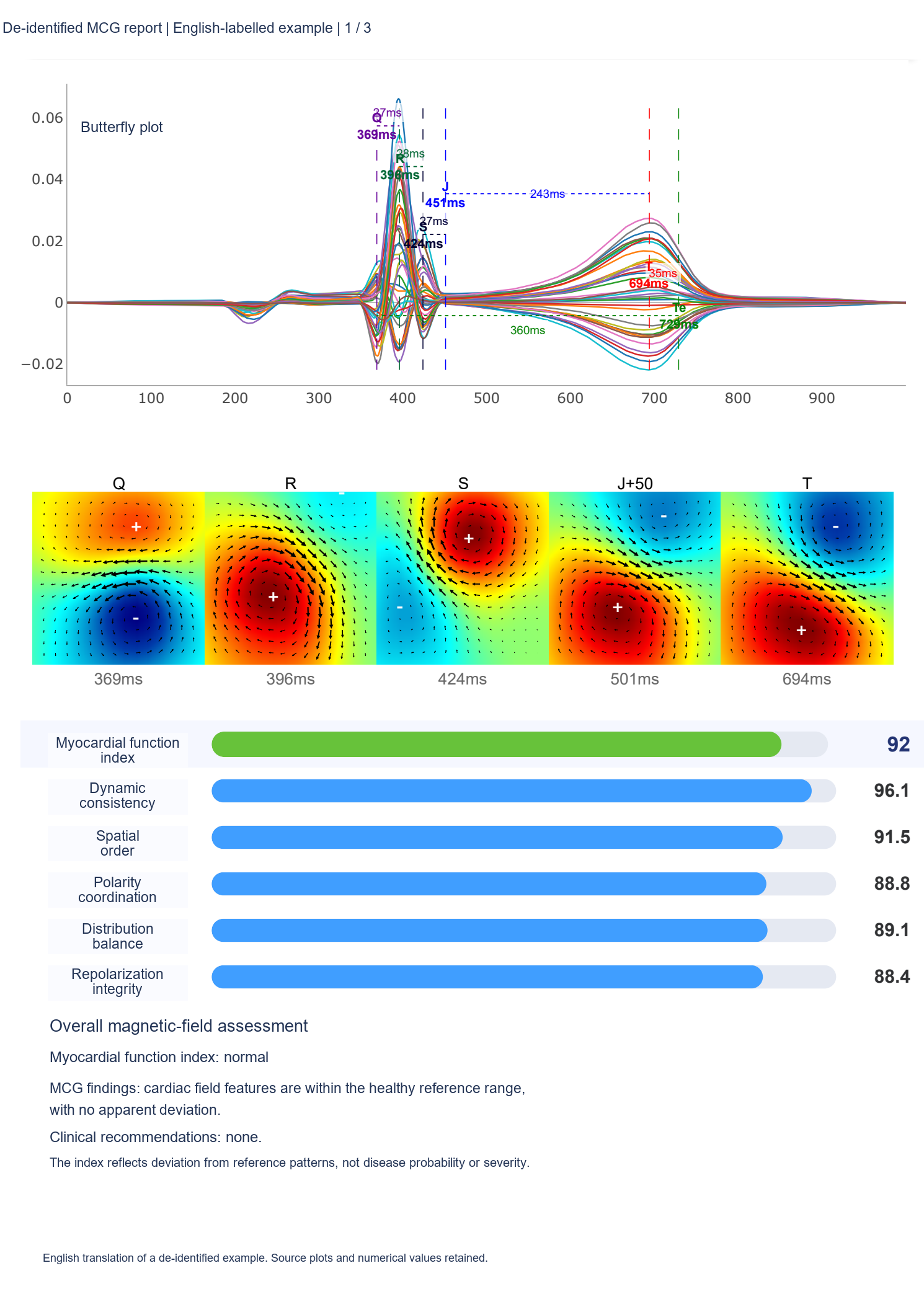 De-identified report, first page: butterfly plot, field maps and analysis results